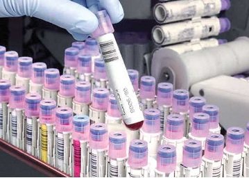 ذخیره سازی ۱۲۰ هزار نمونه خون بند ناف رویان در کشور