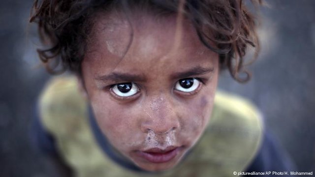 خطر مرگ از گرسنگی جان میلیون‌ها یمنی را تهدید می‌کند