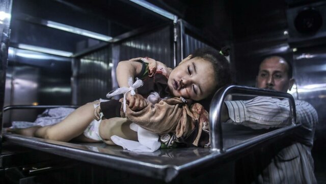 کودک شهید شده در غزه