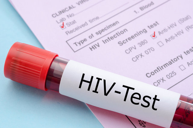 نتایج امیدوار کننده آزمایش “واکسن HIV” در فاز انسانی