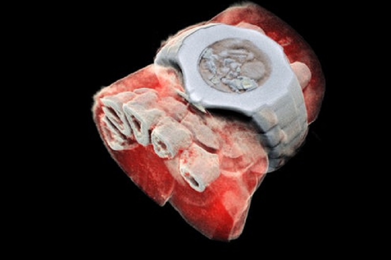 تهیه اولین تصاویر رنگی سه بعدی از بدن انسان