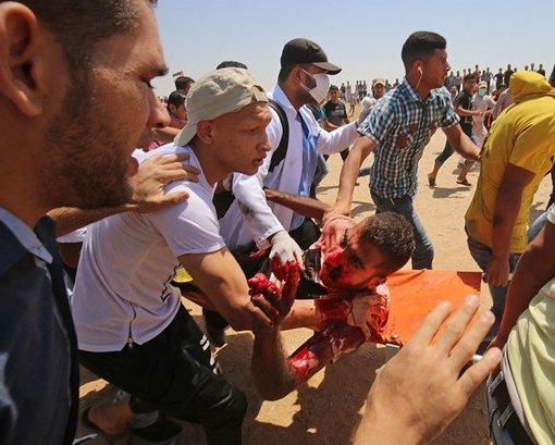 یک شهید و ۲۲۰ زخمی در حملات نیروهای اشغالگر به تظاهرکنندگان در مرزهای غزه