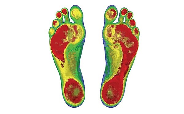 استفاده از یک جلسه اسکن کف پا در مرکز پزشکی مهر گستر با ۹۰درصد تخفیف